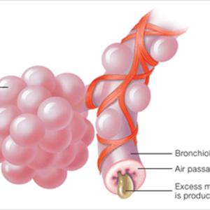 Cough Bacteria Or Virus 
