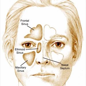 What Treats Asthmatic Bronchitis - ALLERGIC BRONCHITIS And HOMEOPATHY TREATMENT