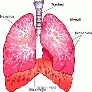 Natural Treatment For Bronchitis 
