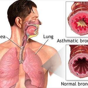  Ways To Monitor Down Emphysema
