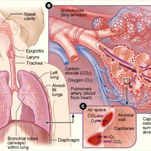 Natural Remedies For Bronchitis 